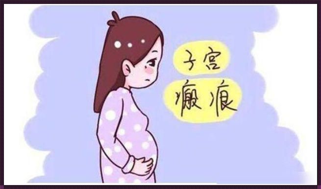 产后康复之道：多躺还是多走？