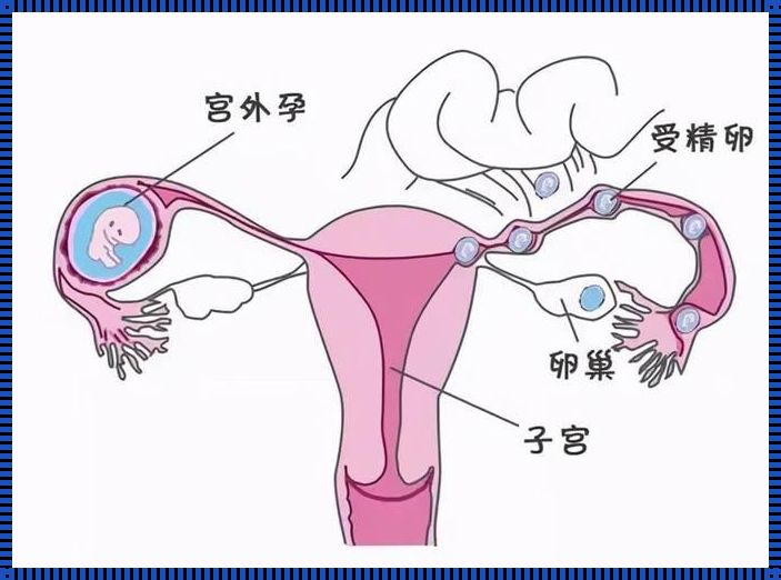 自我诊断输卵管堵塞的秘诀