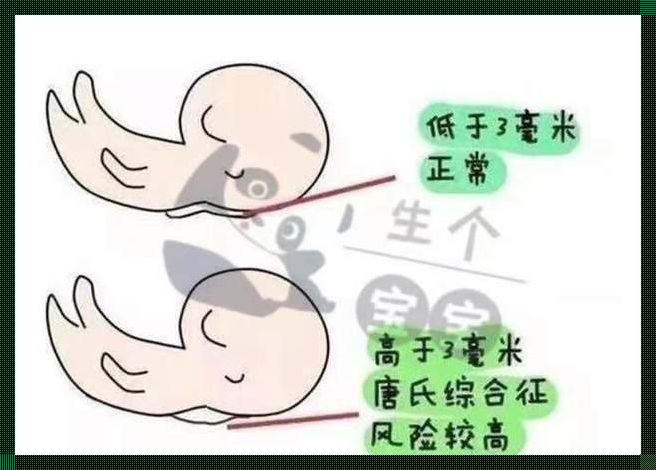 孕二月建档筛查，为母爱保驾护航