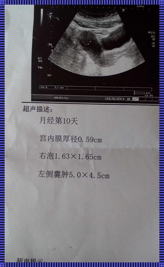 卵泡多大才会排出来：备孕女性的贴心指南