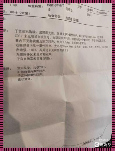 卵巢囊肿无回声：探秘女性备孕路上的“隐形炸弹”