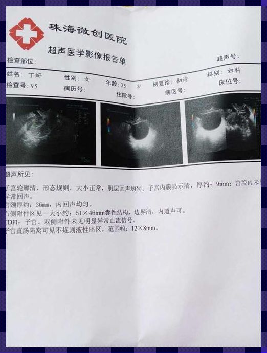 卵巢囊肿大小正常范围是多少mm——备孕路上的惊与喜