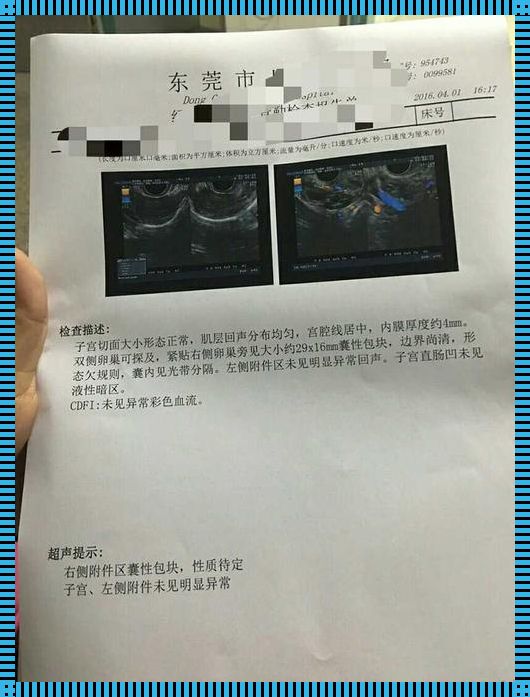 右侧卵巢囊性暗区，备孕路上的“惊鸿一瞥”