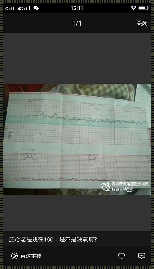 怀孕11周胎心170：缺氧疑云解析