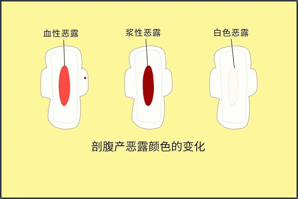 产后修复：剖腹产后恶露颜色变化图的解读与启示