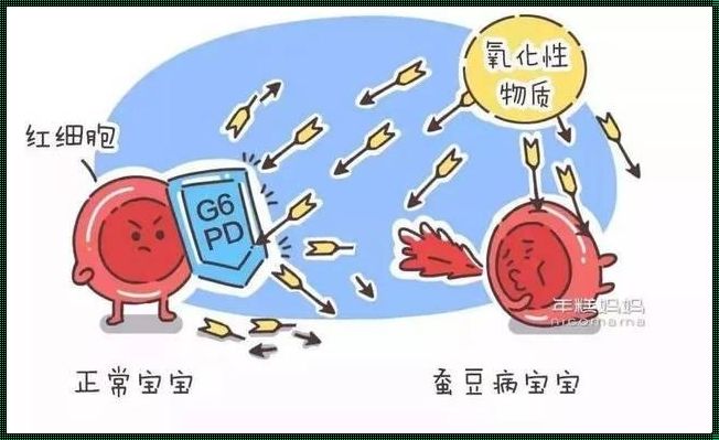 胎儿有蚕豆病需要终止妊娠吗？