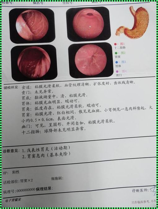 两肋中间胃上方的硬块，我们的勇敢面对