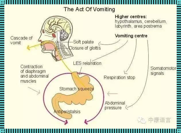 呕吐是反射动作吗？