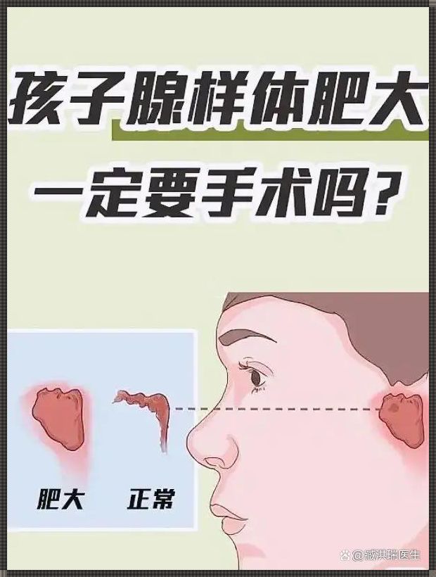 小孩腺样体肥大必须做手术吗？一个令人震惊的话题