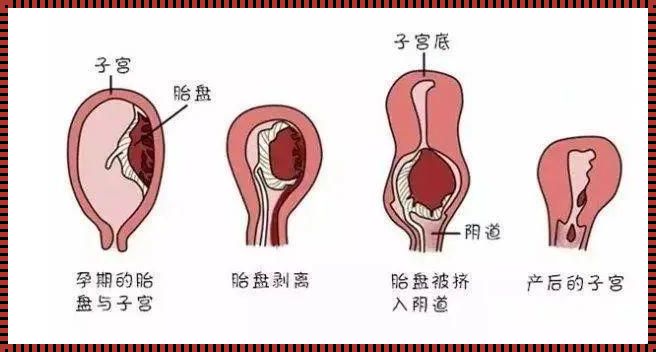 产后15天，子宫竟在肚脐处？揭秘产后妈妈们的惊人变化！