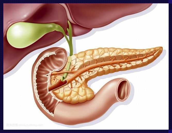 胰腺不适之殇：早期惊现的隐痛