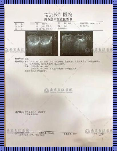 引产后复查B超的正常指标及影响因素