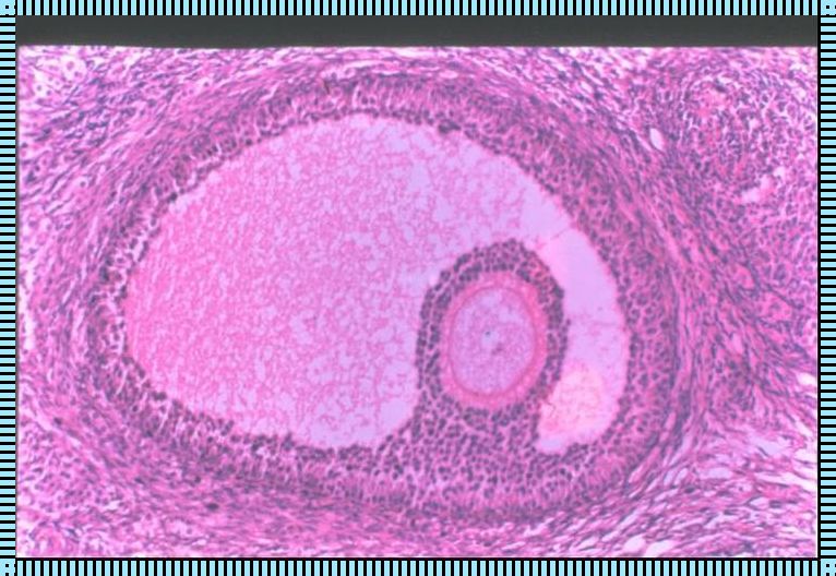 备孕路上惊现有卵丘的卵泡，我们该如何勇敢面对？