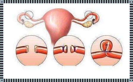 输卵管堵塞最快的恢复方法：科技助力下的备孕之路