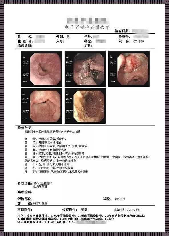 《三度镜中寻：胃镜频繁下的我》