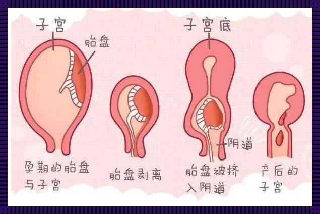 产后子宫体积的变化及其影响因素