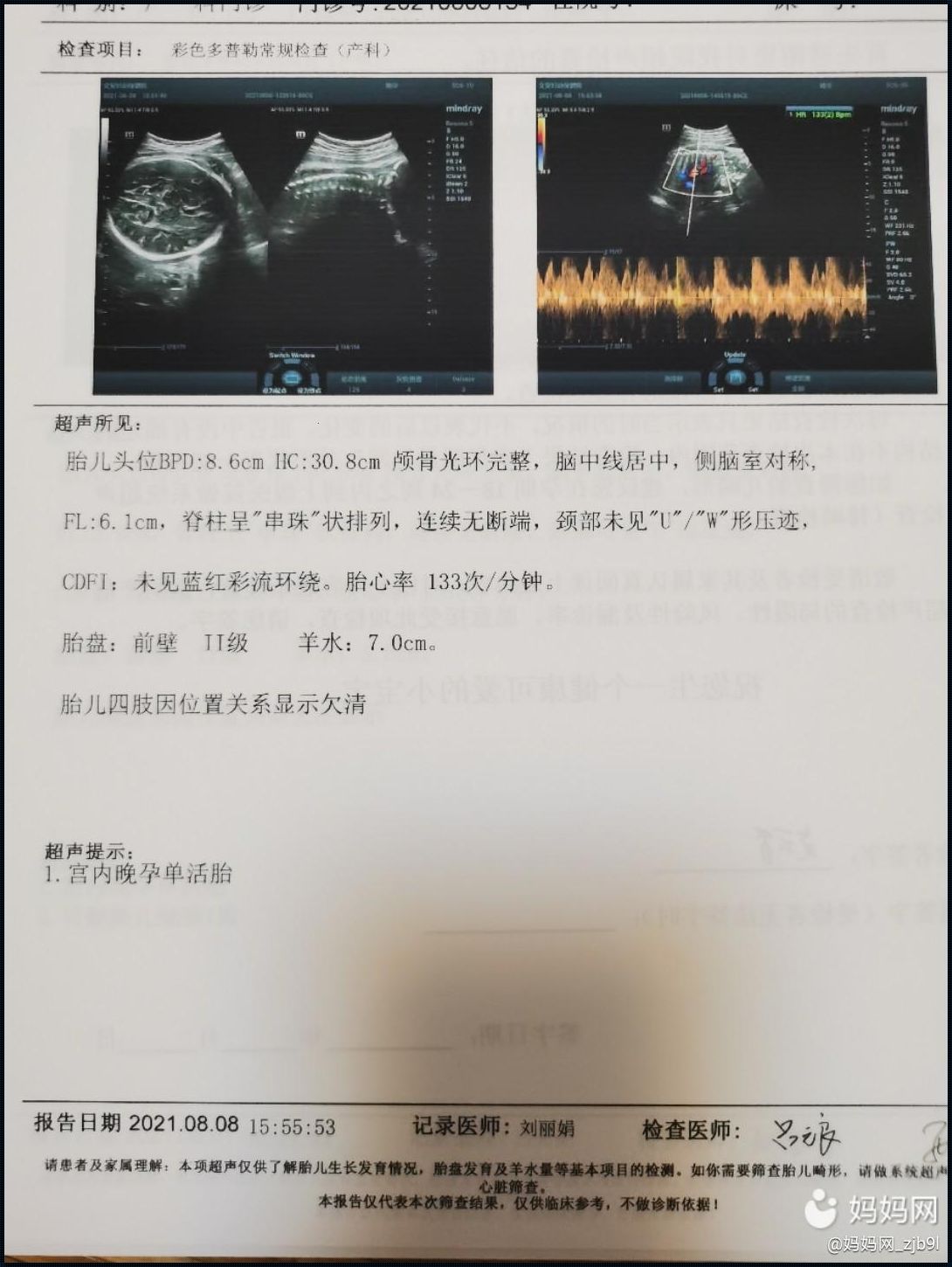 36至39周胎儿体重增长：科学揭秘与孕妈关怀