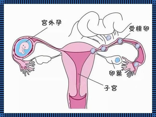 女性单侧输卵管能否怀孕？探索输卵管在生育中的神奇作用