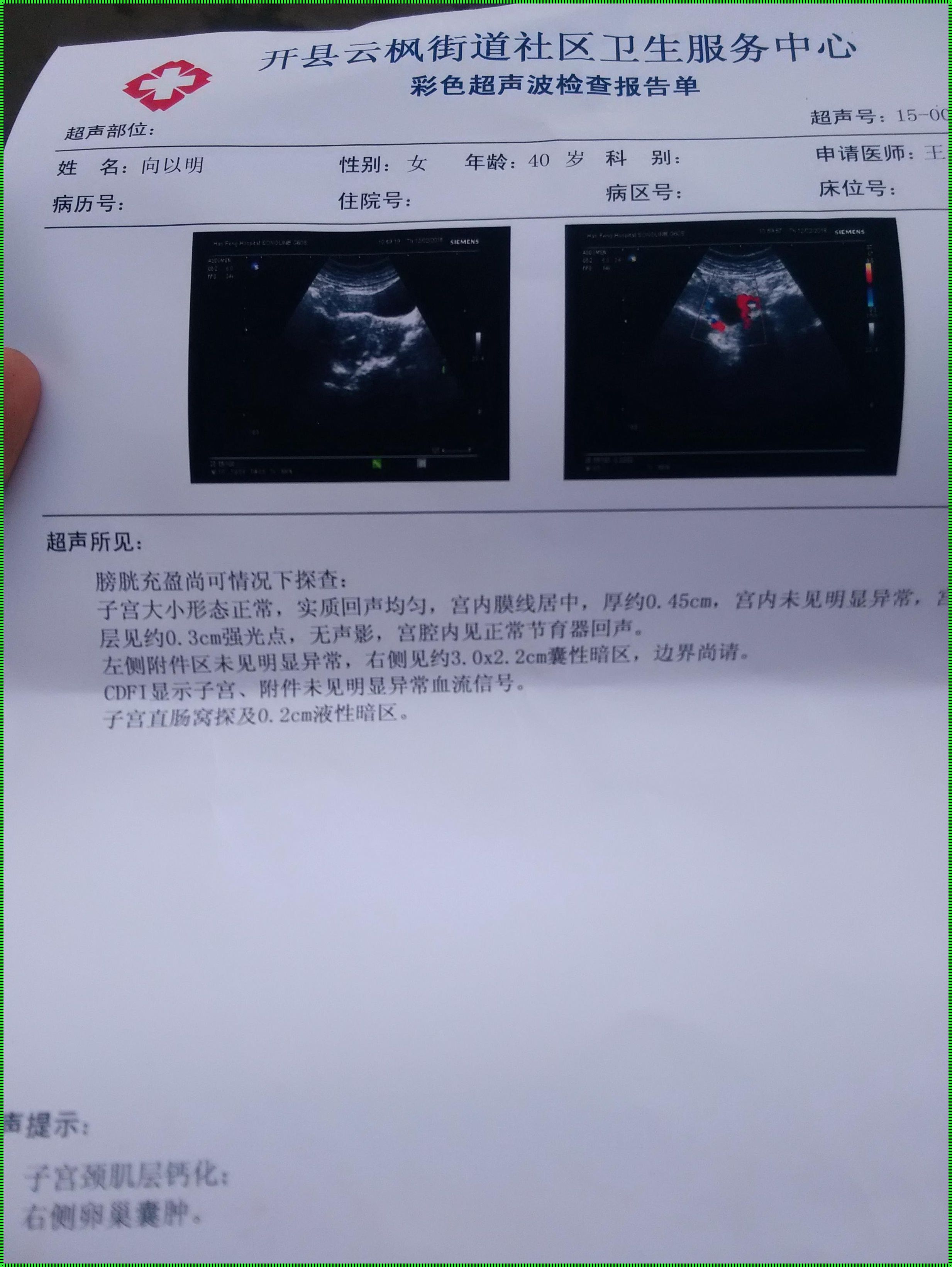 怀孕早期附件有囊肿，我们该如何应对？