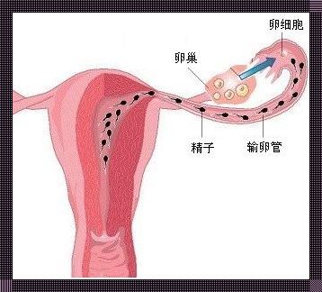 单卵双胎是两个精子吗？