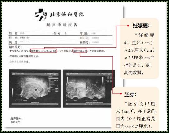 怀孕40天B超，遇见宝宝的神奇时刻