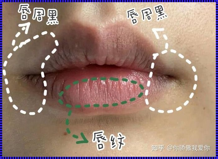 去唇周黑的方法：让双唇重现亮丽光彩