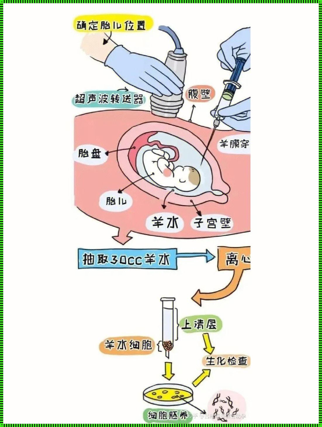 怀孕20周羊水量少于16周，原因何在？