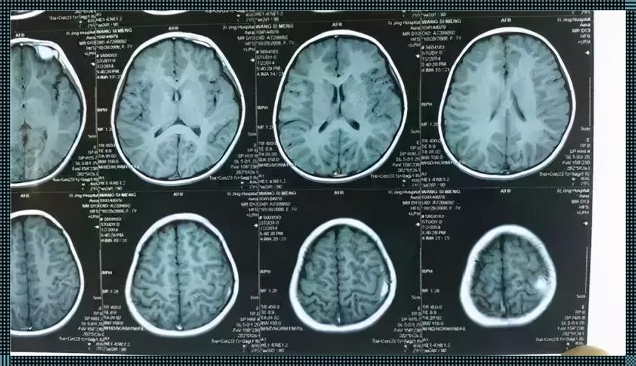 八个月婴儿聪明的表现：育儿惊现