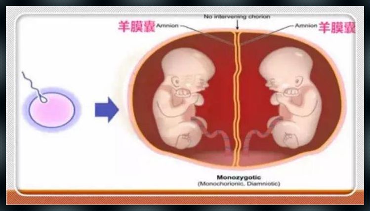 单绒双羊超过37周有什么危险——惊现孕期新挑战