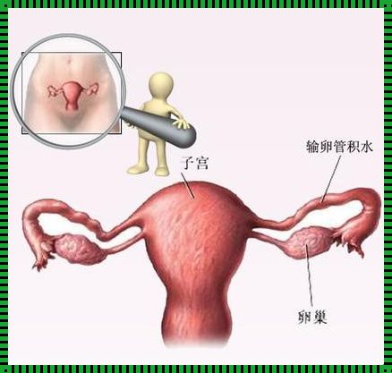 如何判断输卵管是否正常——备孕路上的重要一环