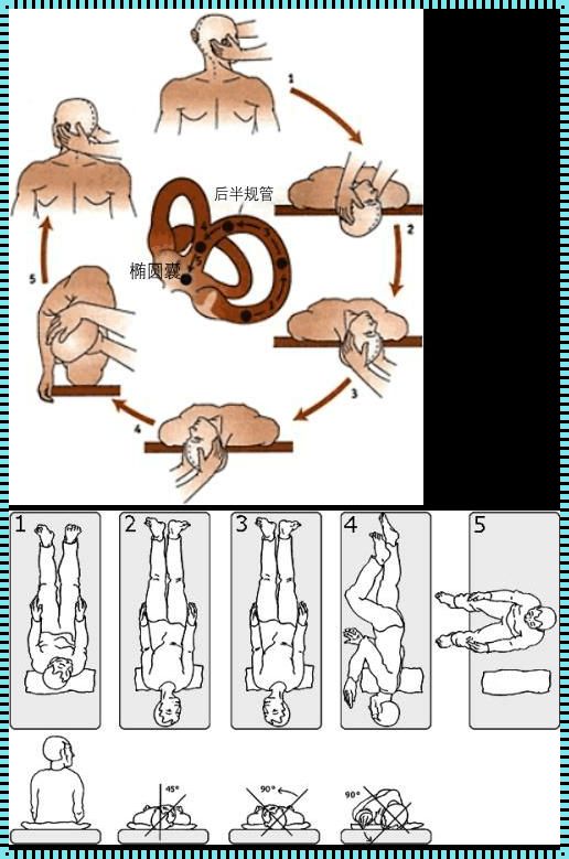 耳石症在家简单复位法：震撼心灵的自我救赎