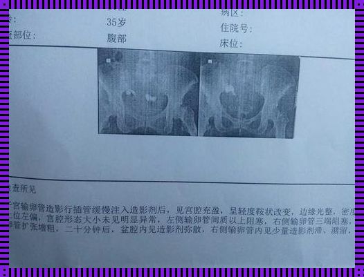 做了阴超医生说输卵管堵塞，备孕之路如何加快？