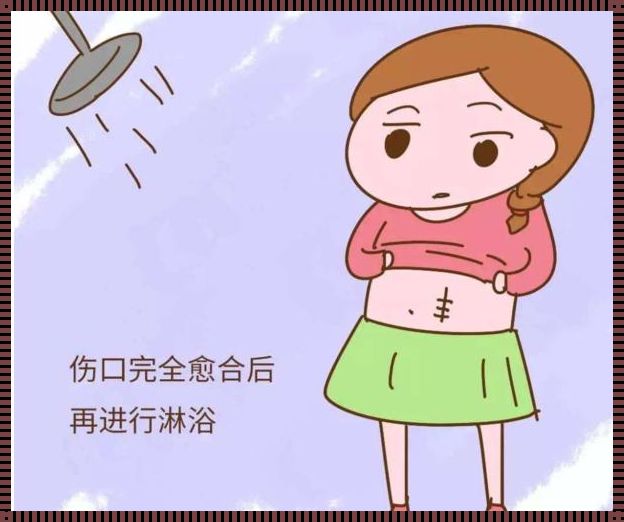 剖腹产后多久可以下冷水：平衡与适应的的艺术