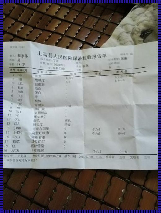 惊现茶色尿，怎么回事？