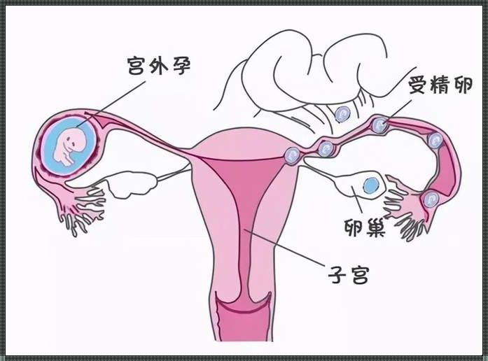 输卵管堵塞怎么造成的原因：探寻生命的奥秘