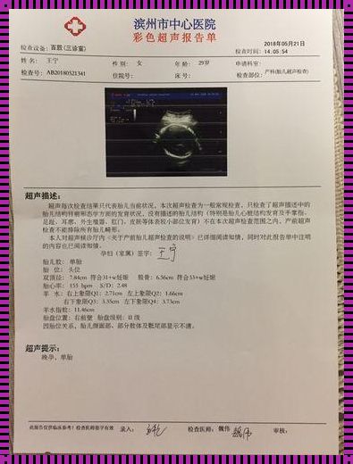 25周四维羊水多少正常——以一位准妈妈的视角探寻怀孕的奥秘