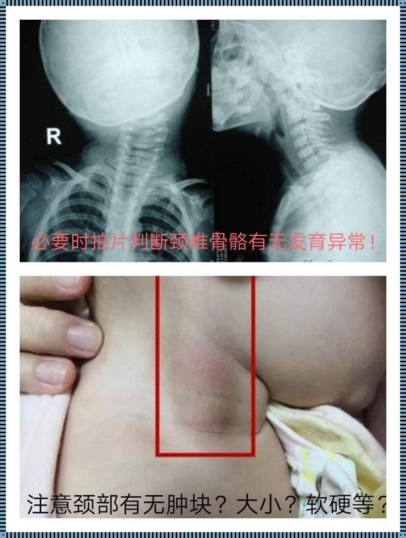 宝宝斜颈怎么判断左右——以神秘与育儿的角度深度探讨