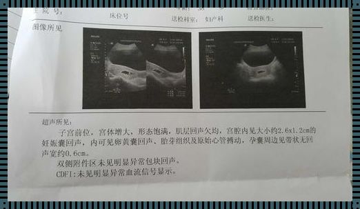 怀孕7周有胎心胎芽宫腔积血：我的真实经历与感悟