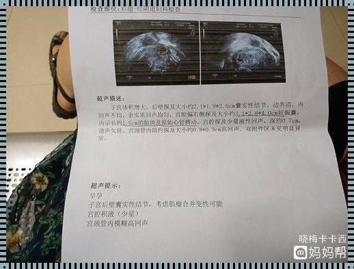 先兆性流产可以不管吗——我的亲身经历与思考