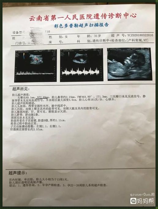 怀孕了NT检查出来宫颈癌前兆：揭开神秘面纱