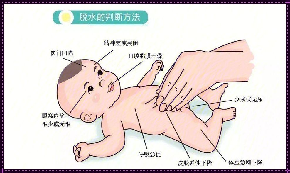 小孩脱水有何症状？如何应对？