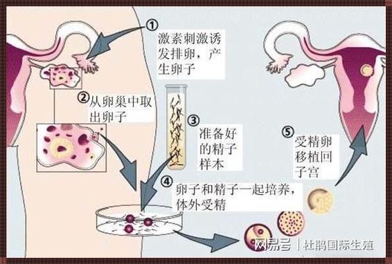 供卵孩子长大后悔了：背后的人性反思