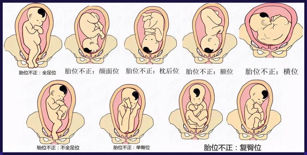 怀孕24周胎位LOA解析：一场温馨的母爱旅程