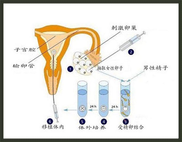 一段特殊的孕育之旅——我的供卵试管婴儿经历