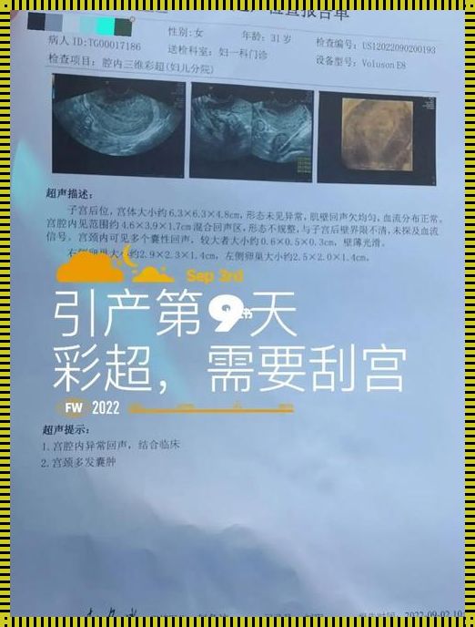 引产后腿酸疼怎么回事？揭秘产后恢复中的奥秘