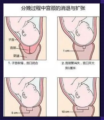 二十八周引产：无痛分娩，温暖相伴