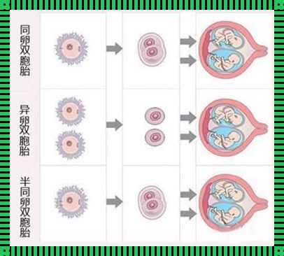 异卵双胞胎概率多少，让你意想不到的真相