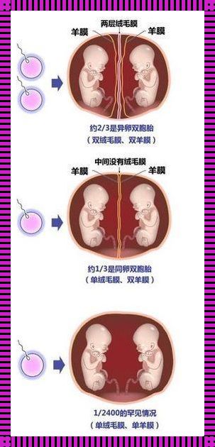 异卵双胞胎概率多少，让你意想不到的真相