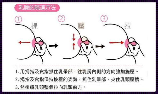 产后涨奶了怎么快速疏通？揭秘实用方法助你轻松应对！