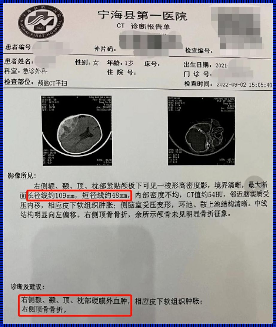 小孩子摔着头了拍CT结果正常：一段育儿分享